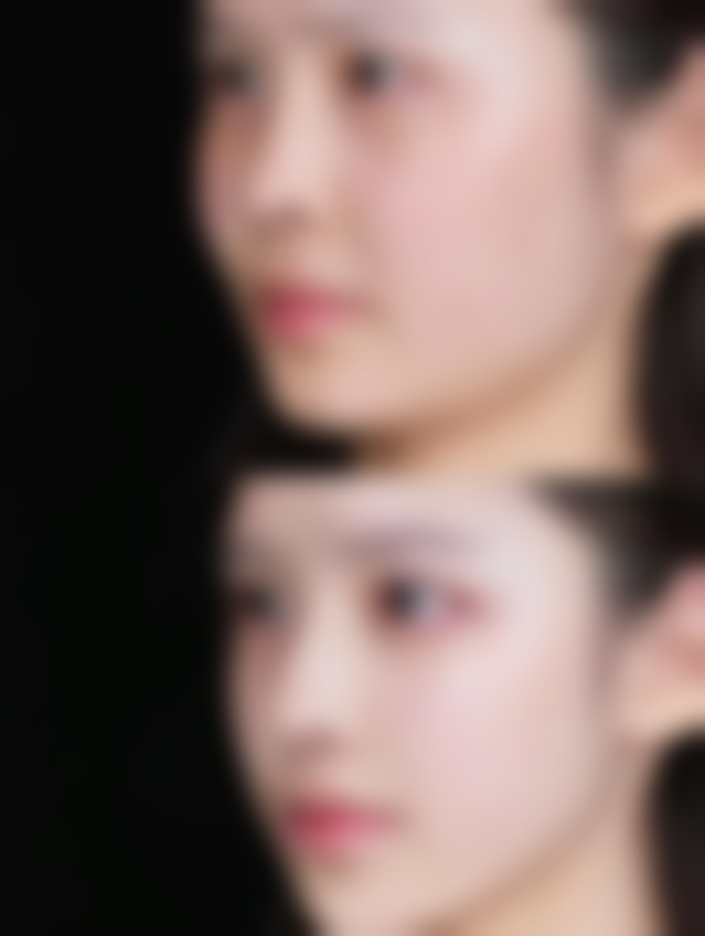 涂抹丰太阳穴靠谱吗？——快速见效真相揭秘