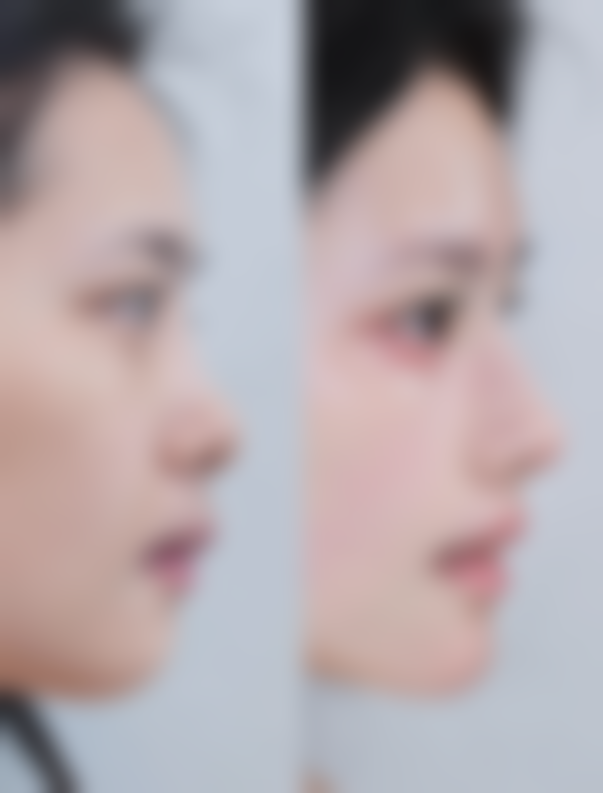 上海德琳医疗美容医院乐威医生的口碑评价与患者认可