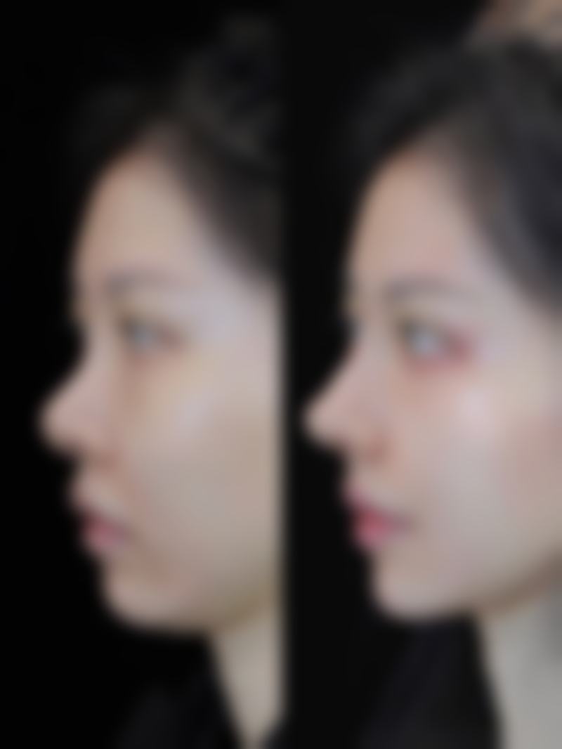 李玉波医生简介做手术价格