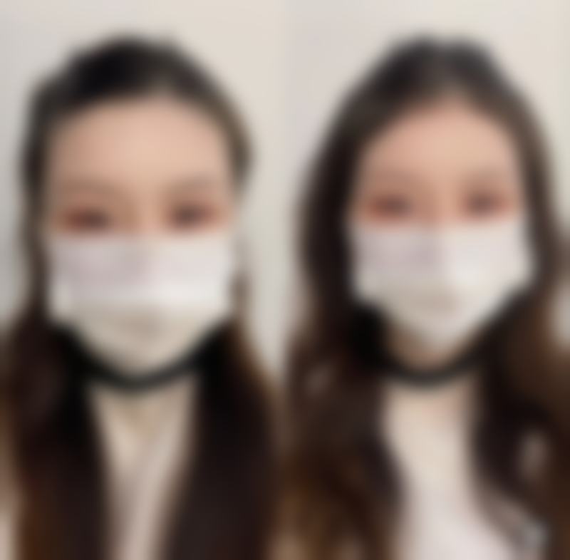 三等甲医院与私立医院埋线成效大比拼之综合考量