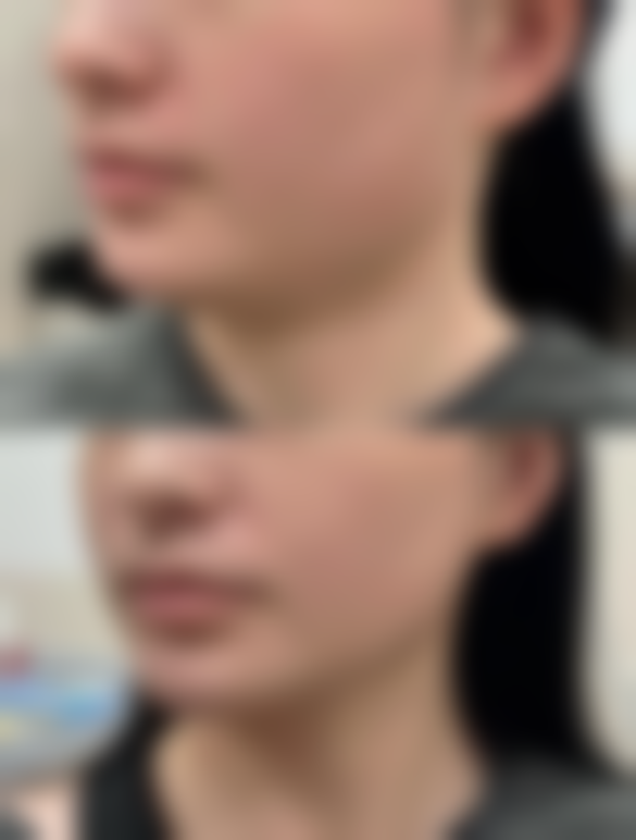 赫喆医生简介做手术价格