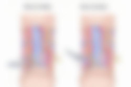 火龙果去眼袋有科学依据吗