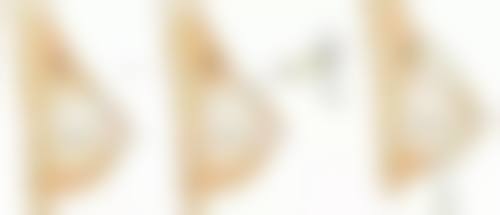 切开双眼皮可以维持多久：术后护理是续命法宝