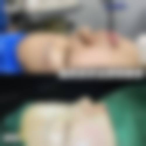 林墅医生简介项目优势