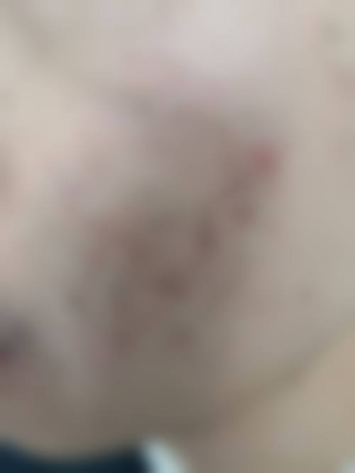 柳州茉莉医疗美容诊所怎么样？可靠吗