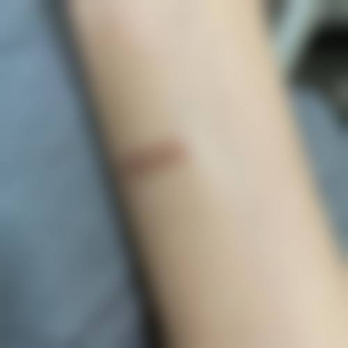 柳州茉莉医疗美容诊所怎么样？更擅长什么手术