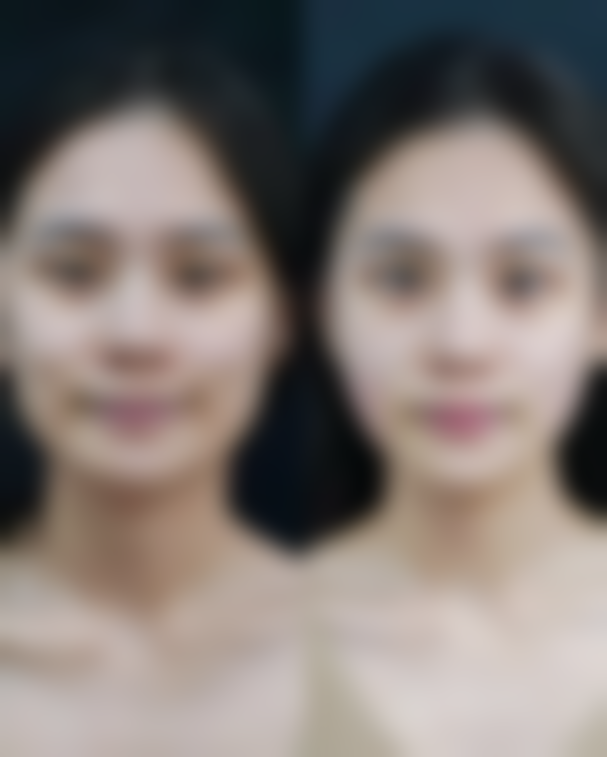 泰国KAMOL咖蒙美容整形医院口碑好不好？附真实患者口碑评价