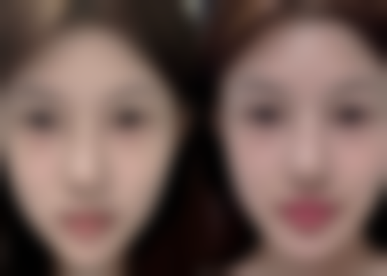 告别疤痕，自信迎接美丽明天