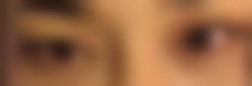 注射隆胸哪种材料好——硅胶假体VS自体脂肪：世纪大PK