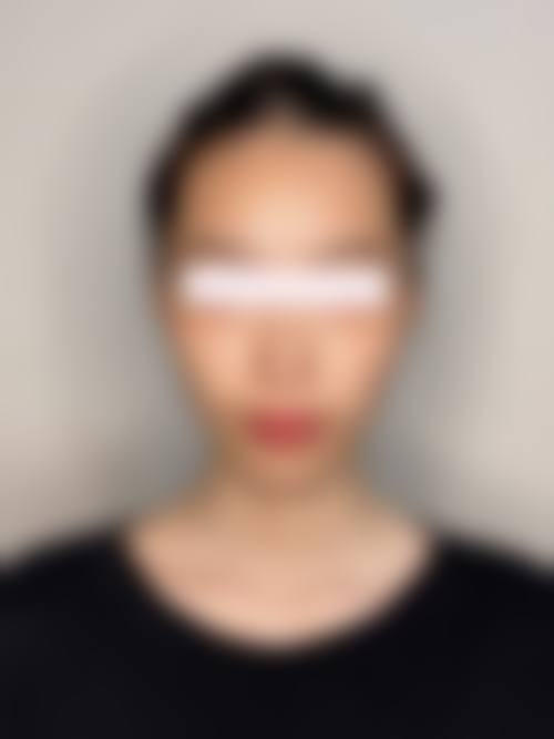 昆明时光医学美容门诊部（原拉雅）顾客实例