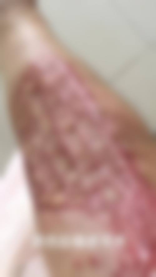 深圳美伊医疗美容诊所怎么样，价格表情况