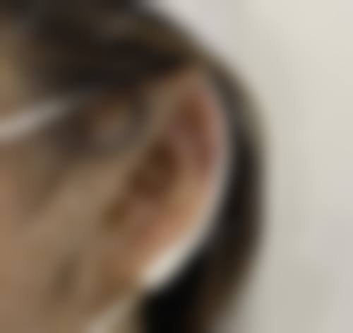 广州现代医院整形美容中 心价格表