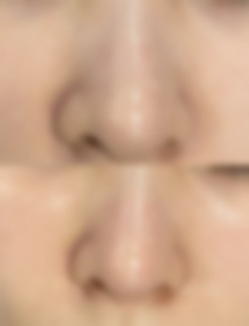 乔志勇医生项目优势