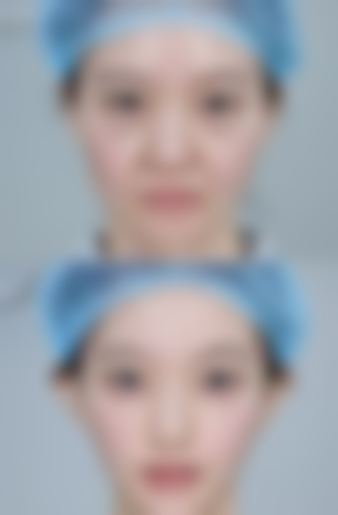 科学应对疤痕疙瘩才是正道