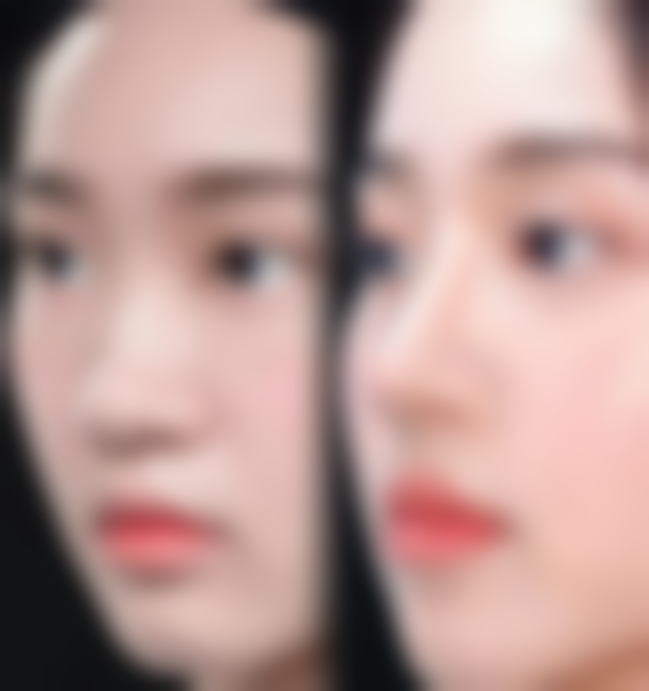 美丽值得投资，但安心更重要！