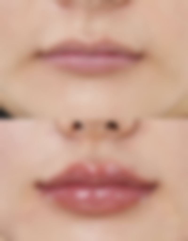 韩国美姿整形外科医院价格表