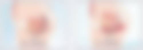 国内各大城市假体取出情况大对比