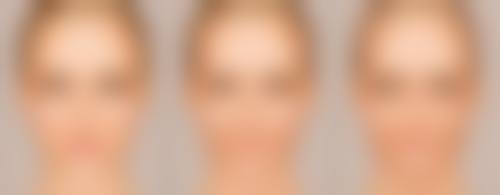 给考虑取出假体的你一些心里话