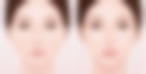 乳房大抽脂,成效究竟如何