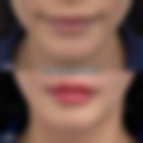 固始易韩医疗美容诊所更擅长什么