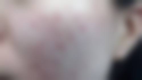 Beauty&Young皮肤科正规吗