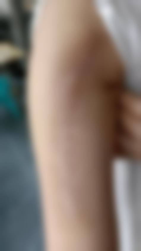 固始易韩医疗美容诊所更擅长什么手术