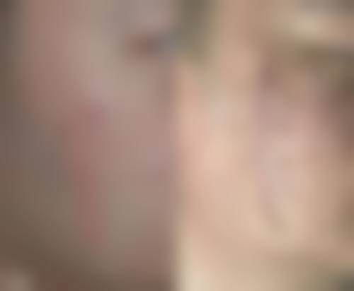 乌鲁木齐整形医院口碑及真实患者评价