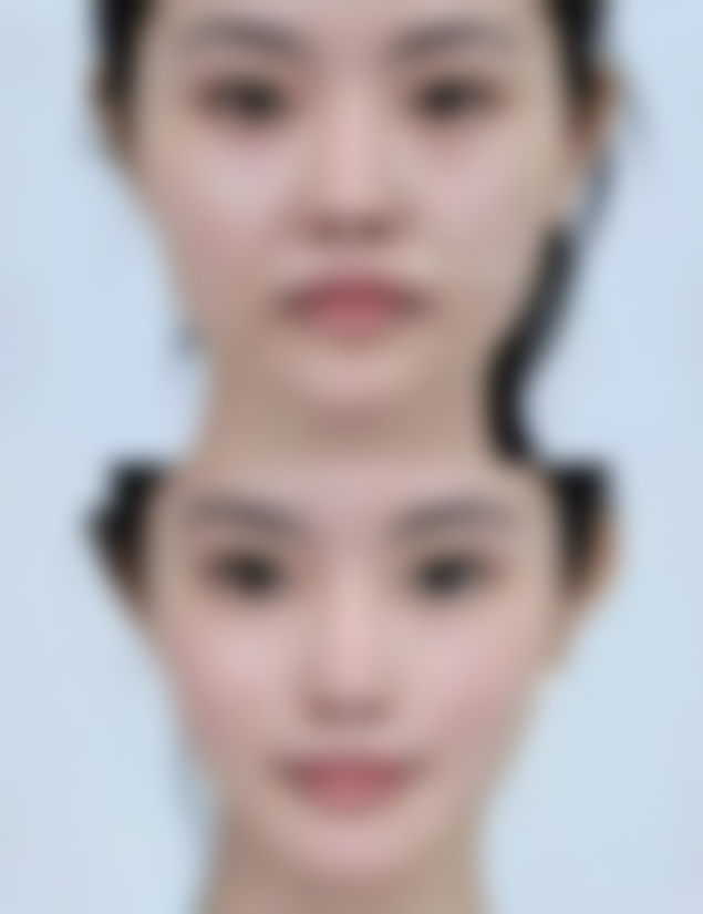 李东英医生简介项目优势