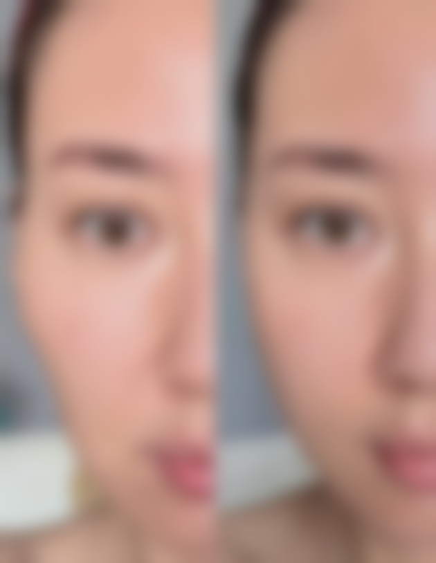 乳房大抽脂,潜藏着哪些风险