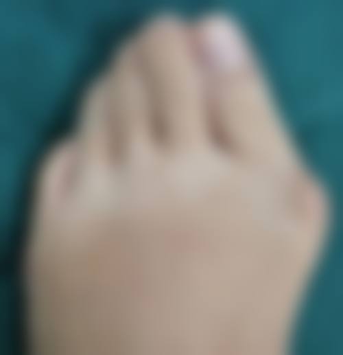 卢宏医生做手术价格