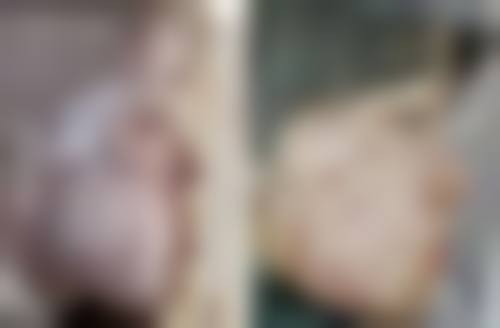 刘锋医生简介口碑如何