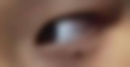 每天眼部按摩去眼袋的至佳频率和时间如何把握