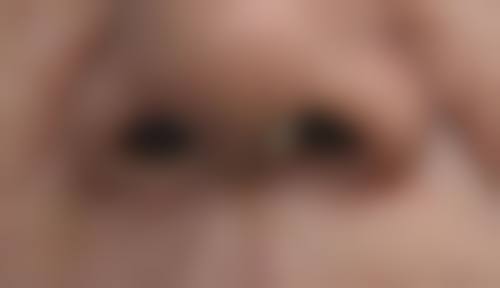 降低乐威阴茎延长术风险保护安心的有效措施