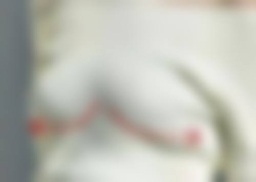 杭州越妍整形医院口碑好不好