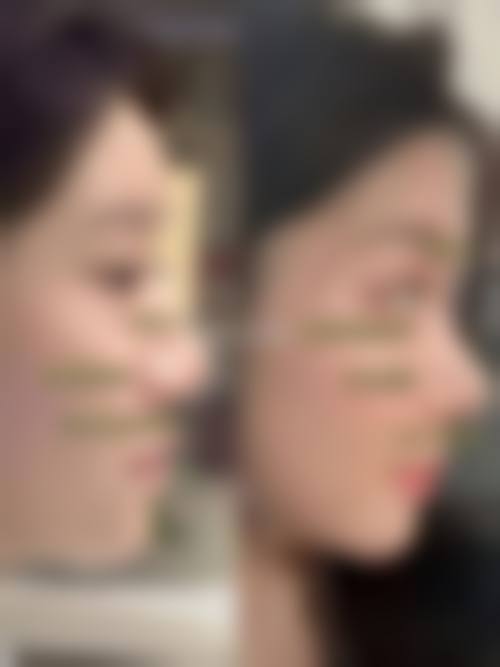 许昌星梵医疗美容门诊部顾客实例