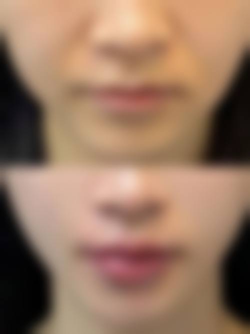 龚细平医生做手术价格：不同项目价格差异