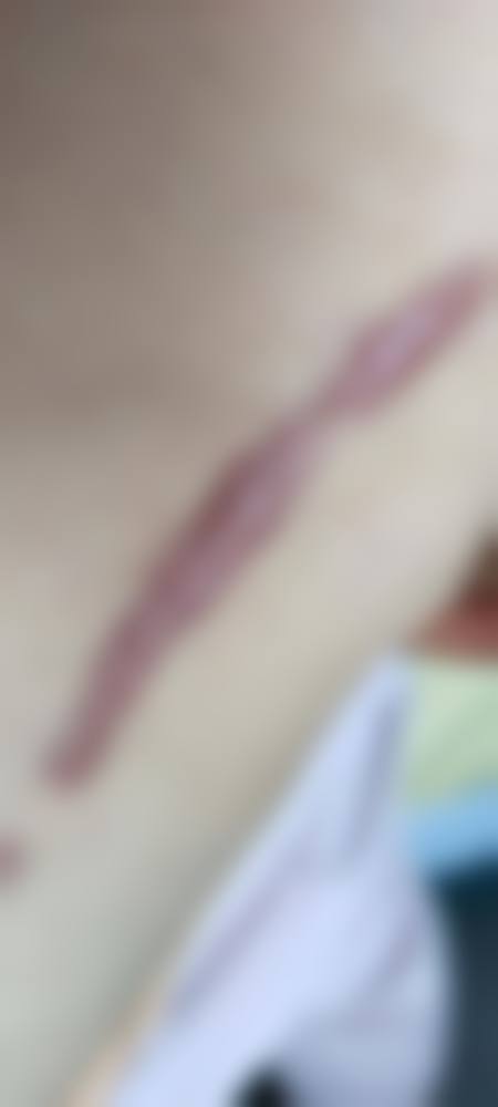 泸州医学校附属医院整形烧伤外科口碑好不好？附真实患者口碑评价