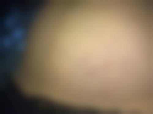 给考虑乐威阴茎延长术者的全方面实用建议