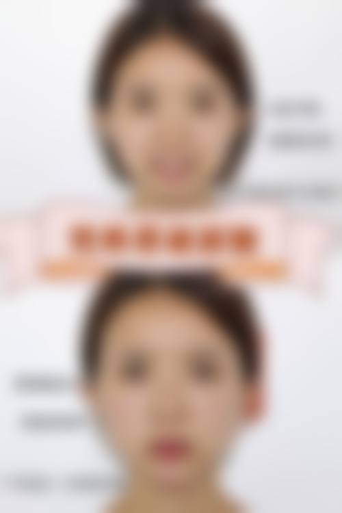 河南省医药院附属医院整形美容科价格表