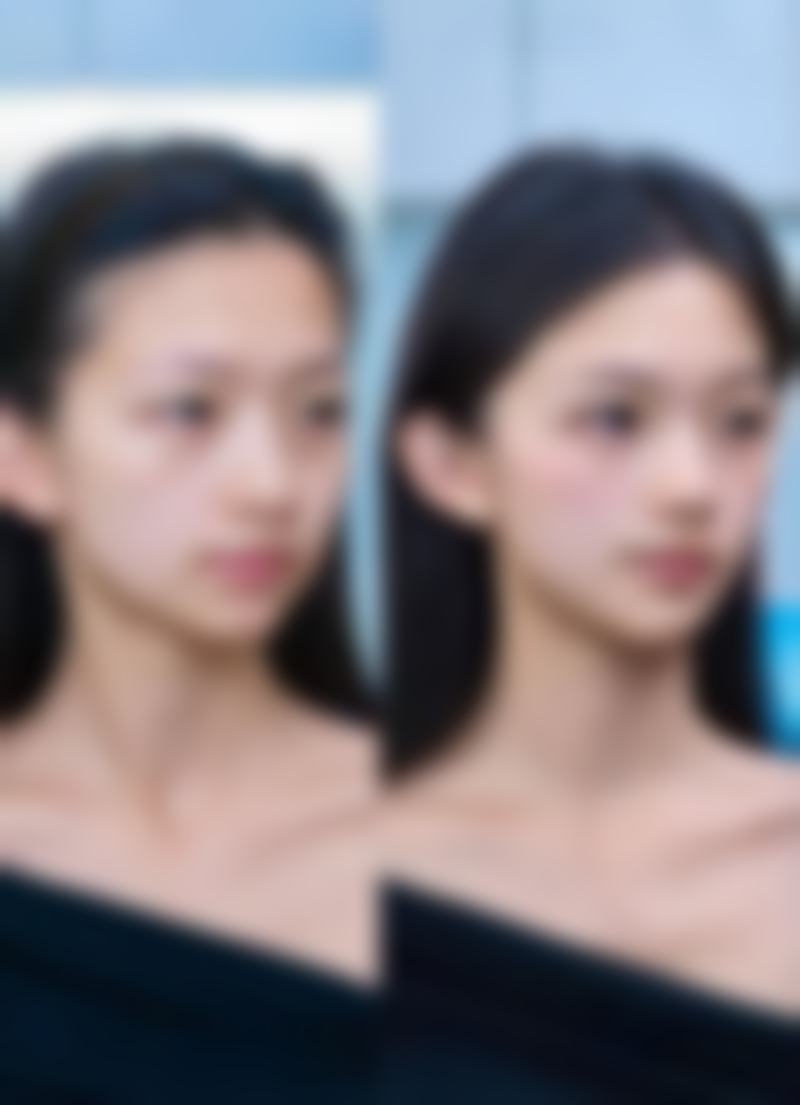 曼托光面与毛面假体对比:各有千秋的选择