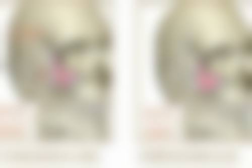 做双眼皮后健身须知：修复期间健身的黄金注意事项