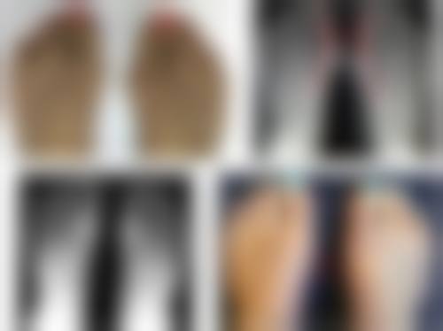 爱贝芙隆鼻是恒久的吗——恒久成效原理之“半恒久”的奥秘