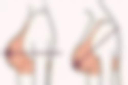 戴星医生做手术价格