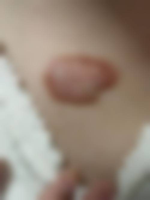 金华王莉医疗美容诊所可靠吗