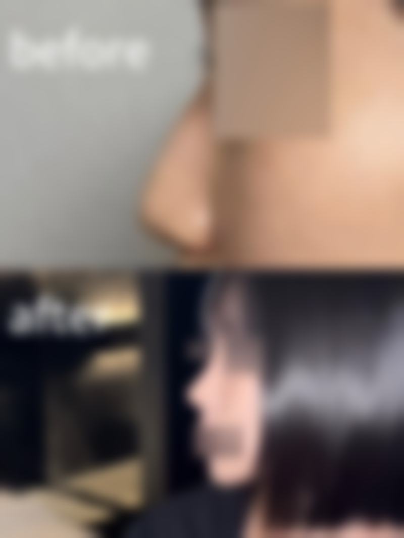 朱铭端医生做手术价格