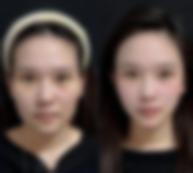 冯露葳医生怎么挂号