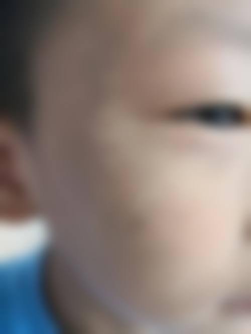 榆树陈伟医疗美容诊所怎么样，更擅长什么手术