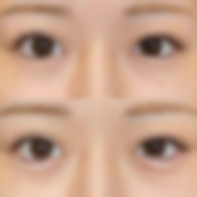 七、山东泰安纯美整形医院口碑好不好？附真实患者口碑评价