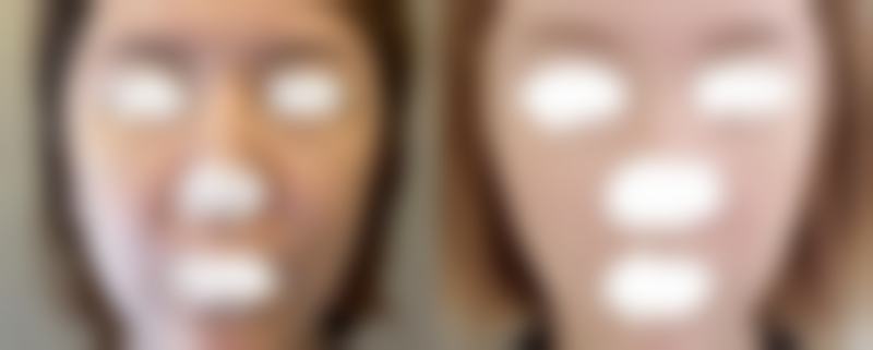 金明勋医生顾客实例图片