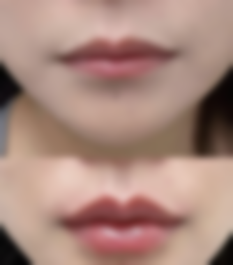 七、漳州市医院整形烧伤科真实患者口碑评价怎么样